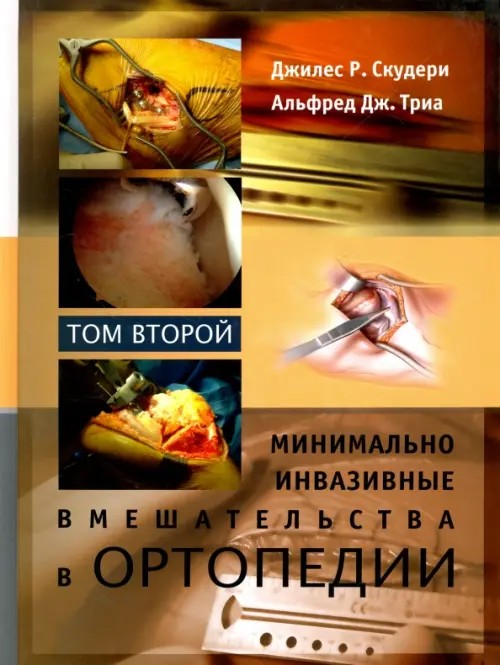 Минимально инвазивные вмешательства в ортопедии: В 2 томах. Том 2